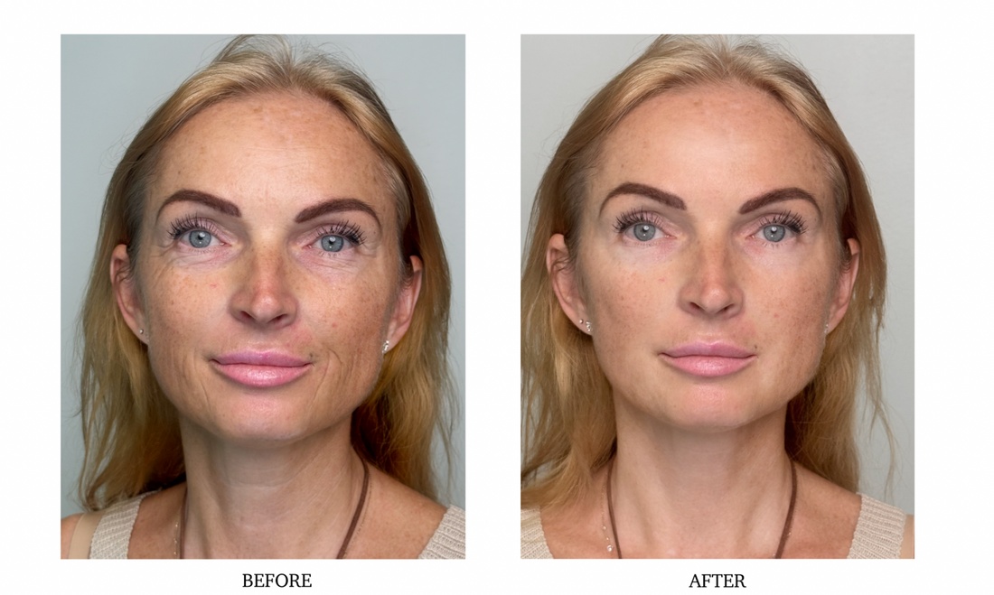 Real people skincare result slide 2