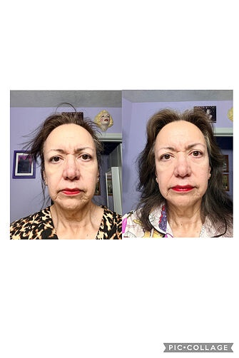 Before and after customer photo