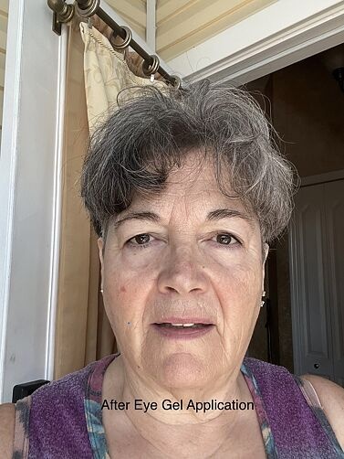 Customer result photo