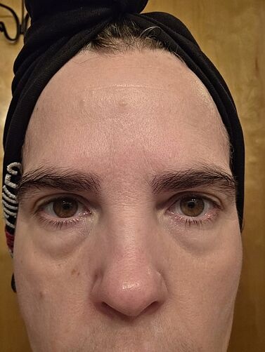 Customer result photo